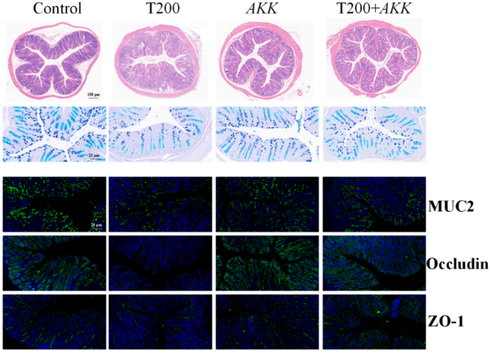 水生所揭示TBPH經(jīng)腸道菌群—花生四烯酸代謝軸促炎癥性腸病發(fā)生
